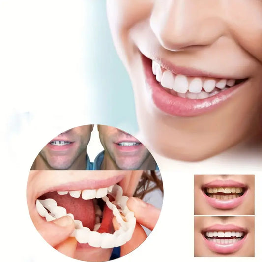 Carillas Dentales Snapon Smile Recupera tu sonrisa en minutos