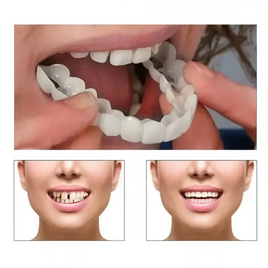 Carillas Dentales Snapon Smile Recupera tu sonrisa en minutos